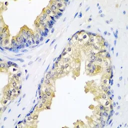 Anti-HAI-2 antibody used in IHC (Paraffin sections) (IHC-P). GTX64596