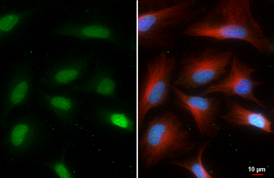 Anti-Histone H3 antibody [HL5419] used in Immunocytochemistry/ Immunofluorescence (ICC/IF). GTX645987