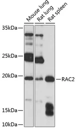 Anti-RAC2 antibody used in Western Blot (WB). GTX64601