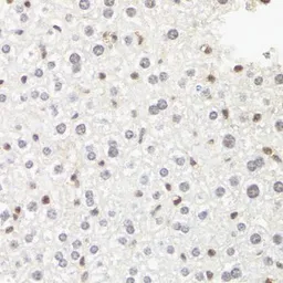 Anti-RPB2 antibody used in IHC (Paraffin sections) (IHC-P). GTX64604
