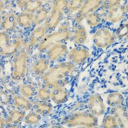 Anti-C1s antibody used in IHC (Paraffin sections) (IHC-P). GTX64606