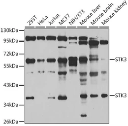 Anti-STK3 antibody used in Western Blot (WB). GTX64607