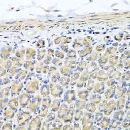 Anti-STK3 antibody used in IHC (Paraffin sections) (IHC-P). GTX64607