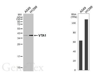 Anti-VTA1 antibody [HL5428] used in Western Blot (WB). GTX646070