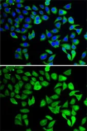 Anti-USP8 antibody used in Immunocytochemistry/ Immunofluorescence (ICC/IF). GTX64608