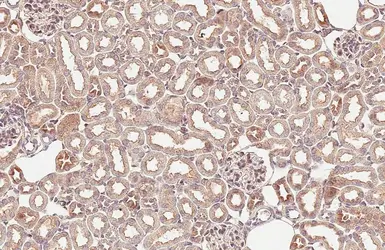 Anti-RAB7A antibody [HL5462] used in IHC (Paraffin sections) (IHC-P). GTX646104