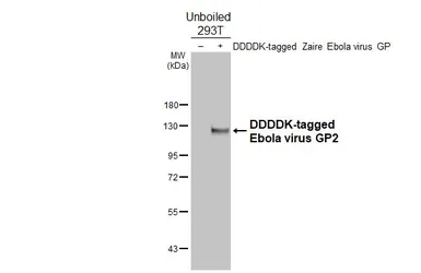 Anti-Ebola virus GP2 antibody [HL5494] used in Western Blot (WB). GTX646158