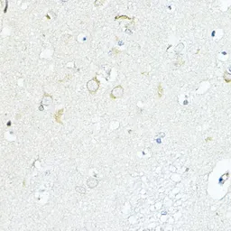 Anti-LRRC59 antibody used in IHC (Paraffin sections) (IHC-P). GTX64620