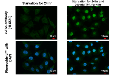 Anti-c-Fos antibody [HL5569] used in Immunocytochemistry/ Immunofluorescence (ICC/IF). GTX646243