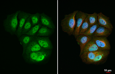 Anti-Retinoid X Receptor alpha antibody [HL5602] used in Immunocytochemistry/ Immunofluorescence (ICC/IF). GTX646284