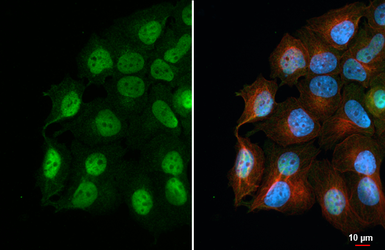 Anti-Retinoid X Receptor alpha antibody [HL5604] used in Immunocytochemistry/ Immunofluorescence (ICC/IF). GTX646286