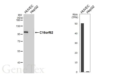 Anti-C16orf62 antibody [HL5629] used in Western Blot (WB). GTX646318