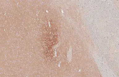 Anti-Cholecystokinin antibody [HL5639] used in IHC (Paraffin sections) (IHC-P). GTX646328