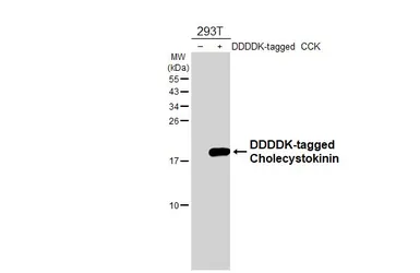 Anti-Cholecystokinin antibody [HL5640] used in Western Blot (WB). GTX646329