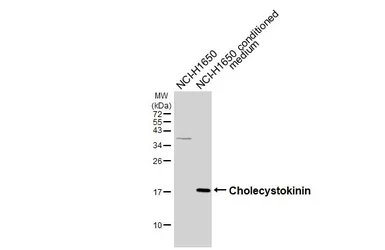 Anti-Cholecystokinin antibody [HL5640] used in Western Blot (WB). GTX646329