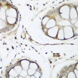 Anti-TAZ antibody used in IHC (Paraffin sections) (IHC-P). GTX64636