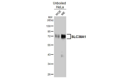 Anti-SLC38A1 antibody [HL5650] used in Western Blot (WB). GTX646459