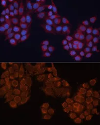 Anti-ALDH6A1 antibody used in Immunocytochemistry/ Immunofluorescence (ICC/IF). GTX64647