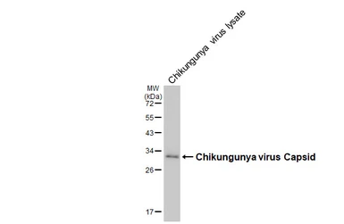Anti-Chikungunya virus Capsid antibody [HL5662] used in Western Blot (WB). GTX646471