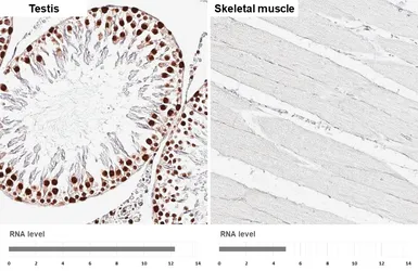 Anti-HNRNPA3 antibody [HL5675] used in IHC (Paraffin sections) (IHC-P). GTX646484