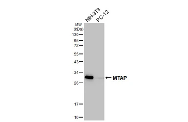 Anti-MTAP antibody [HL5682] used in Western Blot (WB). GTX646491