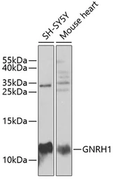 Anti-GnRH1 antibody used in Western Blot (WB). GTX64650