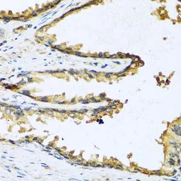 Anti-GnRH1 antibody used in IHC (Paraffin sections) (IHC-P). GTX64650