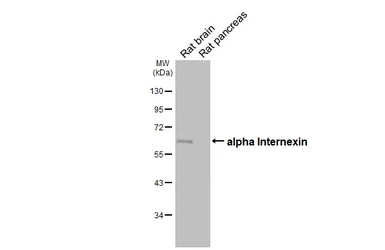 Anti-alpha Internexin antibody [HL5689] used in Western Blot (WB). GTX646520