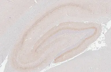 Anti-Cannabinoid receptor 1 antibody [HL5708] used in IHC (Paraffin sections) (IHC-P). GTX646539
