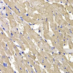 Anti-MPI antibody used in IHC (Paraffin sections) (IHC-P). GTX64661