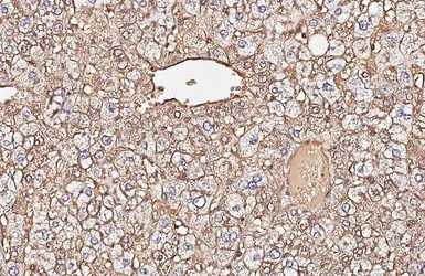 Anti-alpha 1 Antitrypsin antibody [HL5724] used in IHC (Paraffin sections) (IHC-P). GTX646675
