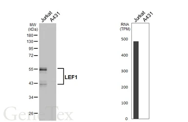 Anti-LEF1 antibody [HL5728] used in Western Blot (WB). GTX646679