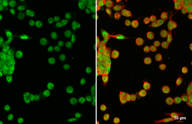 Anti-LEF1 antibody [HL5728] used in Immunocytochemistry/ Immunofluorescence (ICC/IF). GTX646679