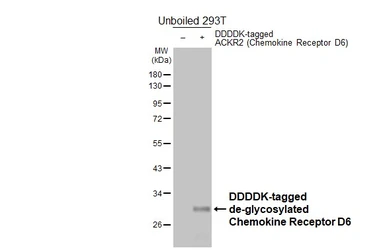 Anti-Chemokine Receptor D6 antibody [HL5734] used in Western Blot (WB). GTX646685