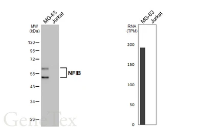 Anti-NFIB antibody [HL5754] used in Western Blot (WB). GTX646705