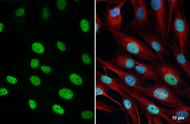 Anti-NFIB antibody [HL5754] used in Immunocytochemistry/ Immunofluorescence (ICC/IF). GTX646705