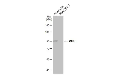 Anti-VGF antibody [HL5755] used in Western Blot (WB). GTX646706
