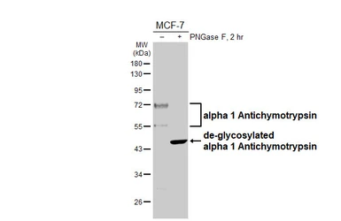 Anti-alpha 1 Antichymotrypsin antibody [HL5762] used in Western Blot (WB). GTX646713