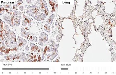 Anti-alpha 1 Antichymotrypsin antibody [HL5762] used in IHC (Paraffin sections) (IHC-P). GTX646713