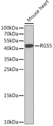 Anti-RGS5 antibody used in Western Blot (WB). GTX64682