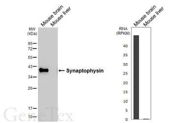 Anti-Synaptophysin antibody [HL5771] used in Western Blot (WB). GTX646842