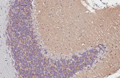 Anti-Synaptophysin antibody [HL5771] used in IHC (Paraffin sections) (IHC-P). GTX646842