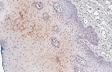 Anti-MGMT antibody [HL5777] used in IHC (Paraffin sections) (IHC-P). GTX646848