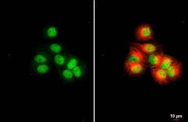 Anti-MGMT antibody [HL5779] used in Immunocytochemistry/ Immunofluorescence (ICC/IF). GTX646850
