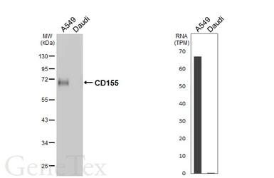Anti-CD155 antibody [HL5788] used in Western Blot (WB). GTX646859