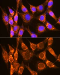 Anti-DMT1 antibody used in Immunocytochemistry/ Immunofluorescence (ICC/IF). GTX64686