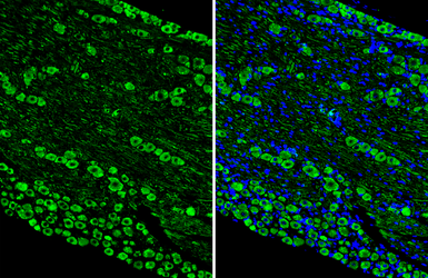 Anti-alpha MSH antibody [HL5798] used in IHC (Paraffin sections) (IHC-P). GTX646869