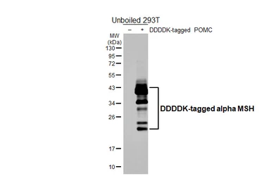 Anti-alpha MSH antibody [HL5798] used in Western Blot (WB). GTX646869