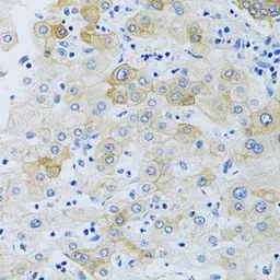 Anti-SLC4A5 antibody used in IHC (Paraffin sections) (IHC-P). GTX64690