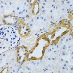 Anti-SLC4A5 antibody used in IHC (Paraffin sections) (IHC-P). GTX64690